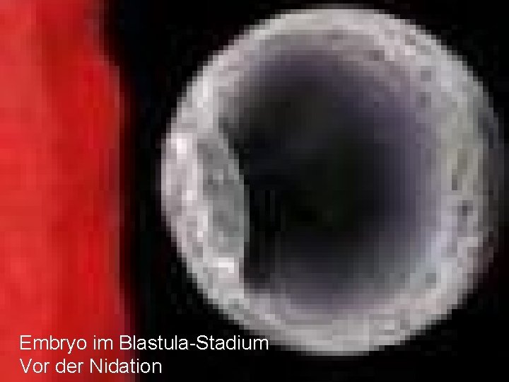 AJF Embryo im Blastula-Stadium Vor der Nidation 