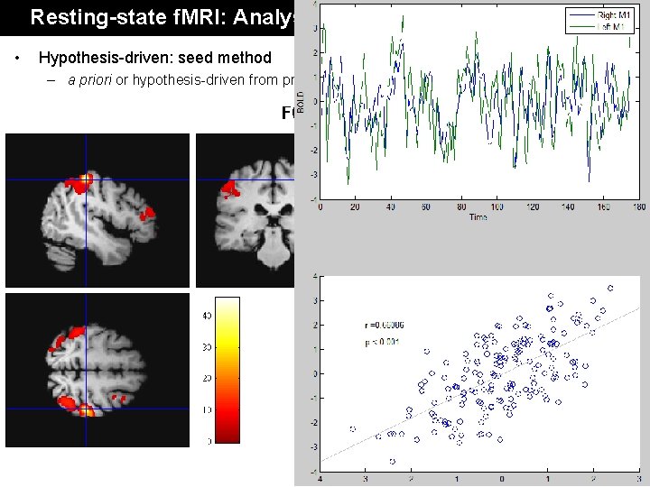 Resting-state f. MRI: Analysis • Hypothesis-driven: seed method – a priori or hypothesis-driven from