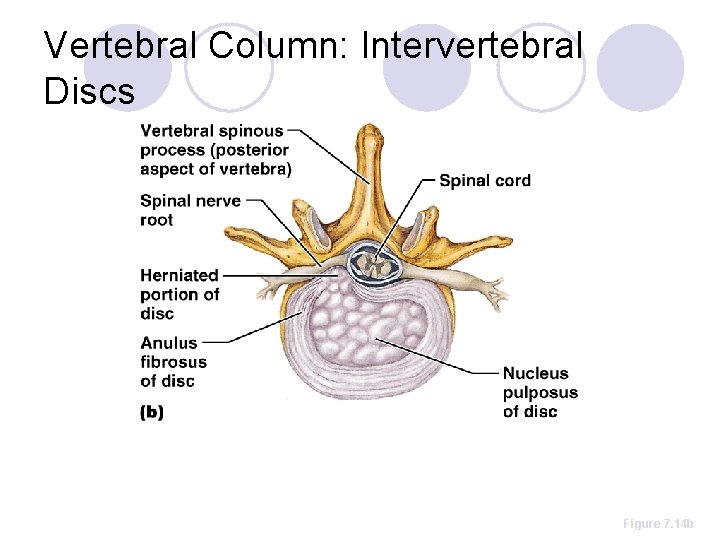 Vertebral Column: Intervertebral Discs Figure 7. 14 b 