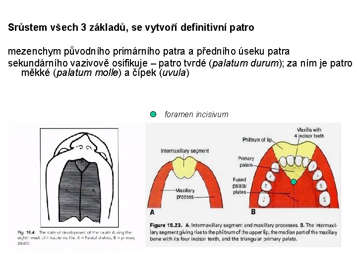 Srůstem všech 3 základů, se vytvoří definitivní patro mezenchym původního primárního patra a předního