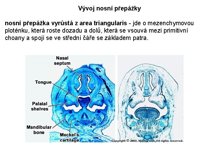 Vývoj nosní přepážky nosní přepážka vyrůstá z area triangularis - jde o mezenchymovou ploténku,