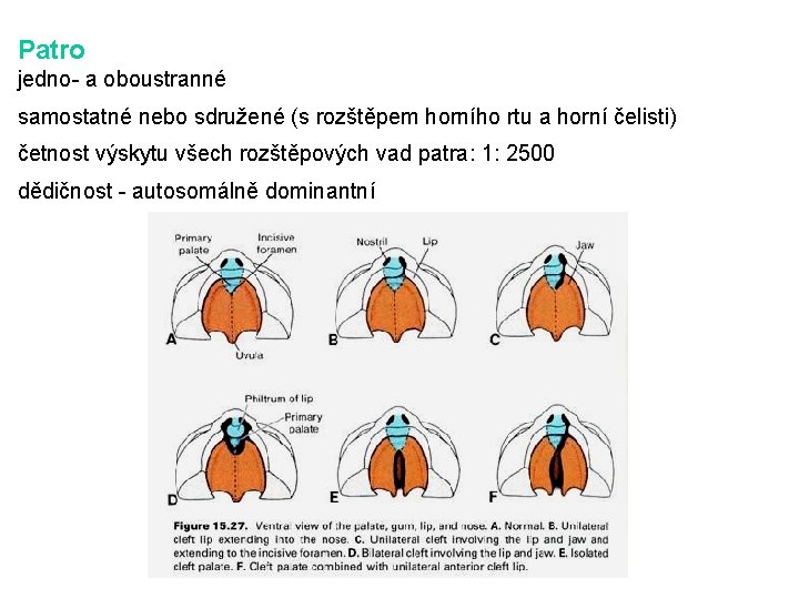 Patro jedno- a oboustranné samostatné nebo sdružené (s rozštěpem horního rtu a horní čelisti)