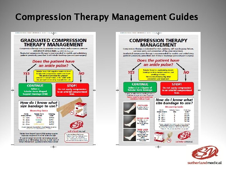 Compression Therapy Management Guides 