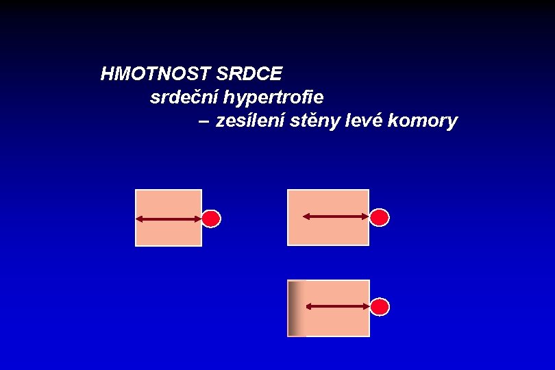 HMOTNOST SRDCE srdeční hypertrofie – zesílení stěny levé komory 
