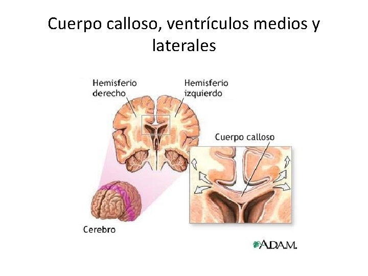 Cuerpo calloso, ventrículos medios y laterales 