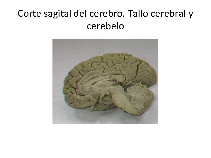 Corte sagital del cerebro. Tallo cerebral y cerebelo 