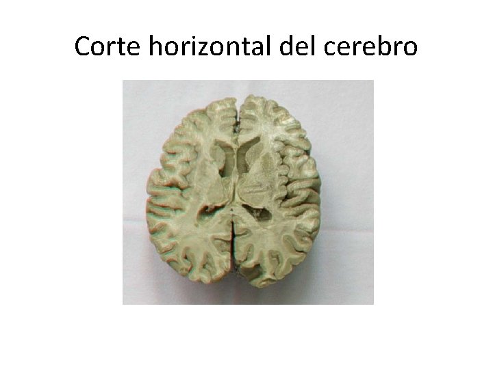 Corte horizontal del cerebro 