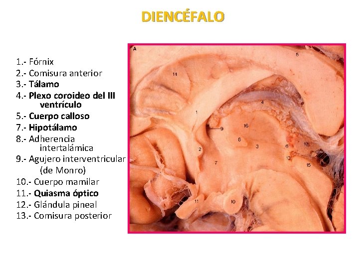 DIENCÉFALO 1. - Fórnix 2. - Comisura anterior 3. - Tálamo 4. - Plexo