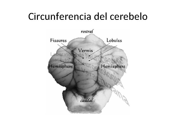 Circunferencia del cerebelo 