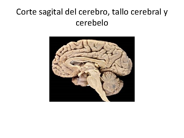 Corte sagital del cerebro, tallo cerebral y cerebelo 