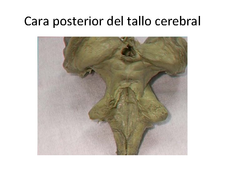 Cara posterior del tallo cerebral 