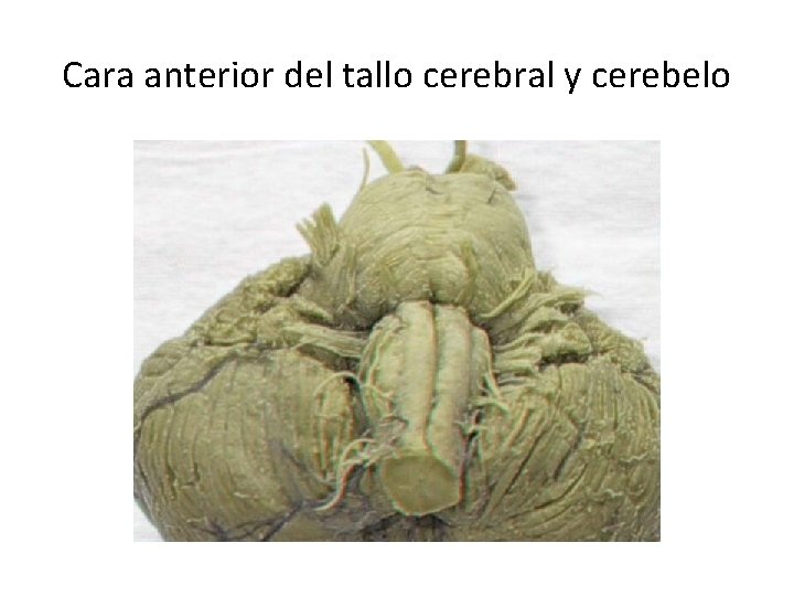 Cara anterior del tallo cerebral y cerebelo 