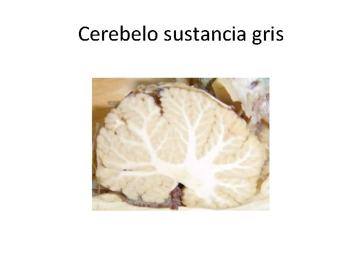 Cerebelo sustancia gris 