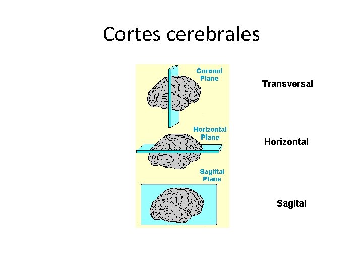 Cortes cerebrales Transversal Horizontal Sagital 