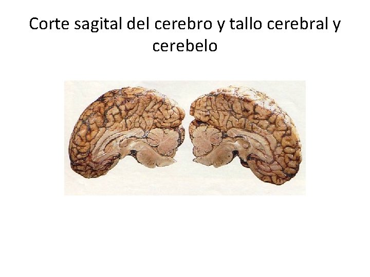 Corte sagital del cerebro y tallo cerebral y cerebelo 