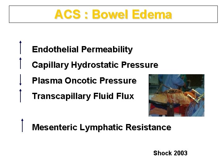 ACS : Bowel Edema Endothelial Permeability Capillary Hydrostatic Pressure Plasma Oncotic Pressure Transcapillary Fluid