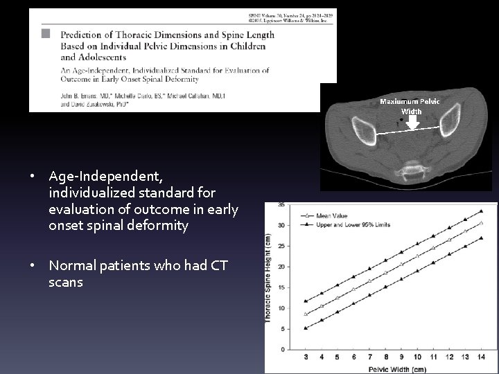  • Age-Independent, individualized standard for evaluation of outcome in early onset spinal deformity