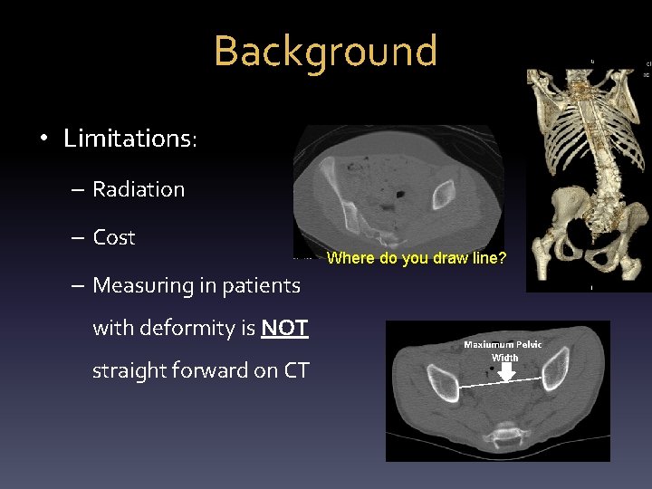 Background • Limitations: – Radiation – Cost – Measuring in patients with deformity is