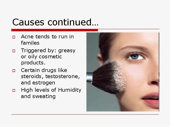 Causes continued… o o Acne tends to run in familes Triggered by: greasy or