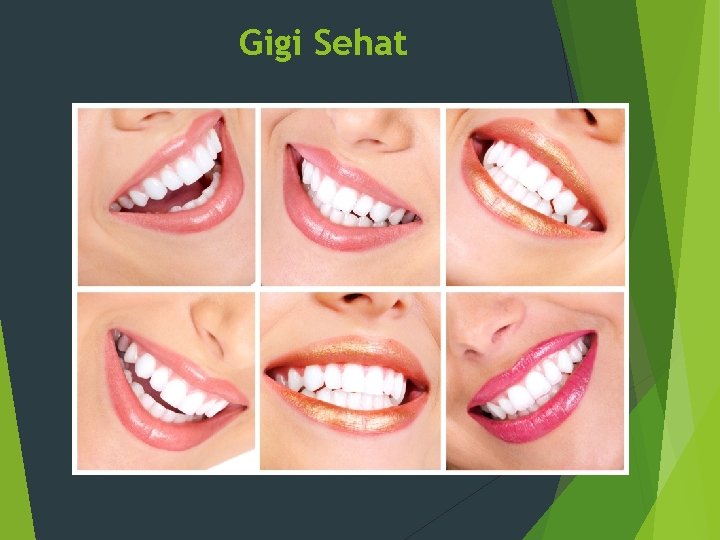 Gigi Sehat 