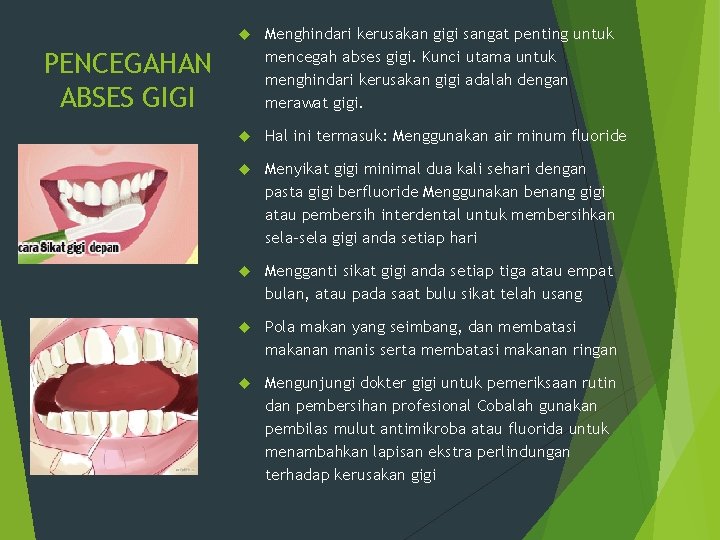  Menghindari kerusakan gigi sangat penting untuk mencegah abses gigi. Kunci utama untuk menghindari