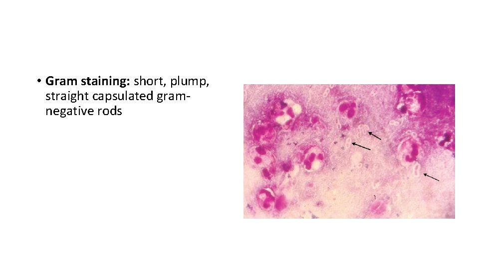 Laboratory Diagnosis • Gram staining: short, plump, straight capsulated gramnegative rods 