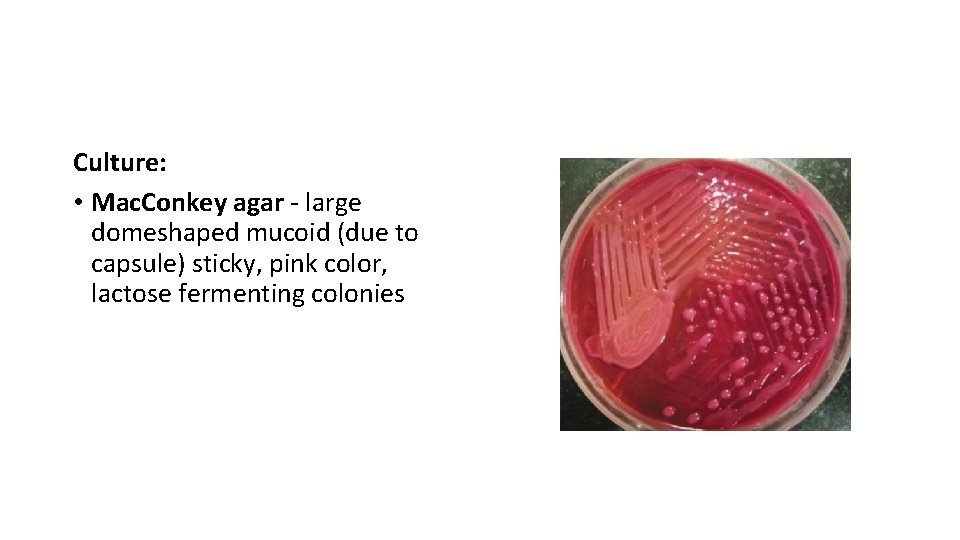 Laboratory Diagnosis Culture: • Mac. Conkey agar - large domeshaped mucoid (due to capsule)