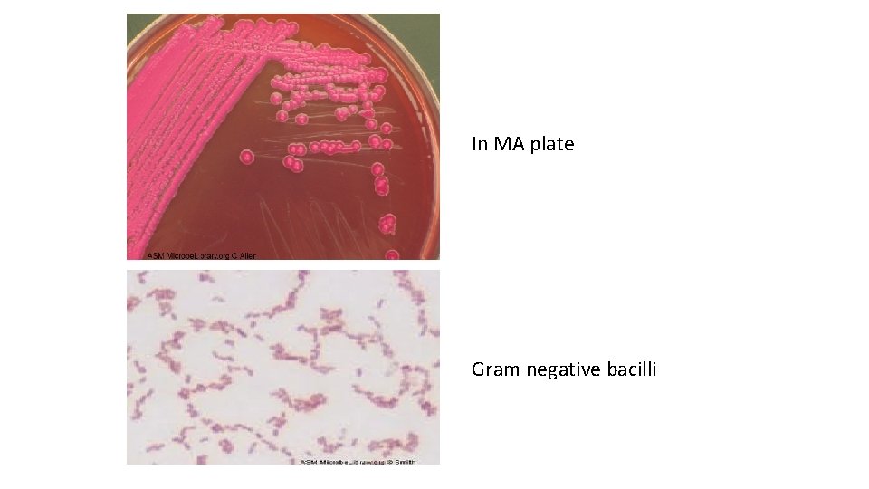 In MA plate Gram negative bacilli 