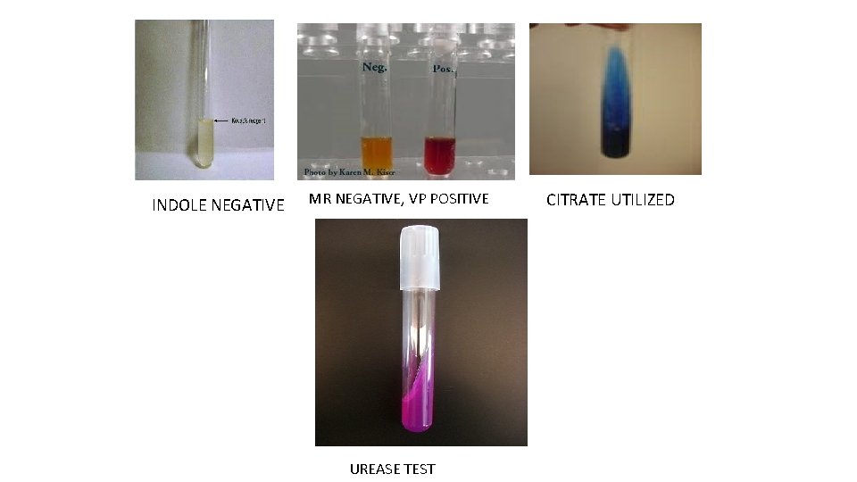 INDOLE NEGATIVE MR NEGATIVE, VP POSITIVE UREASE TEST CITRATE UTILIZED 