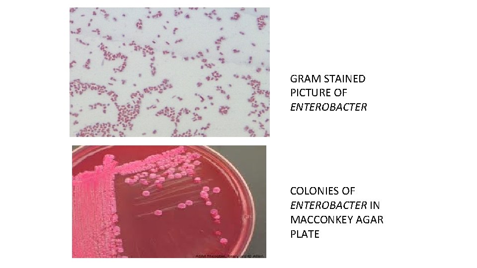 GRAM STAINED PICTURE OF ENTEROBACTER COLONIES OF ENTEROBACTER IN MACCONKEY AGAR PLATE 