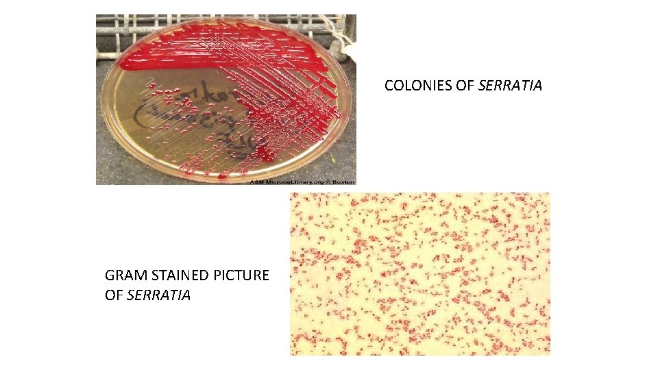 COLONIES OF SERRATIA GRAM STAINED PICTURE OF SERRATIA 