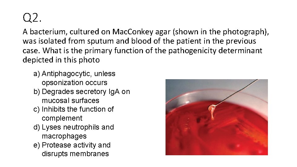 Q 2. A bacterium, cultured on Mac. Conkey agar (shown in the photograph), was