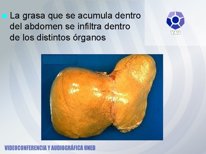 n La grasa que se acumula dentro del abdomen se infiltra dentro de los