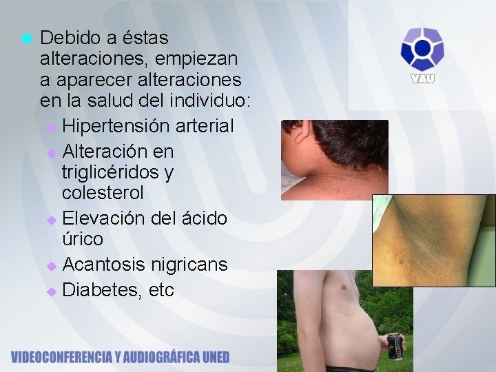 n Debido a éstas alteraciones, empiezan a aparecer alteraciones en la salud del individuo: