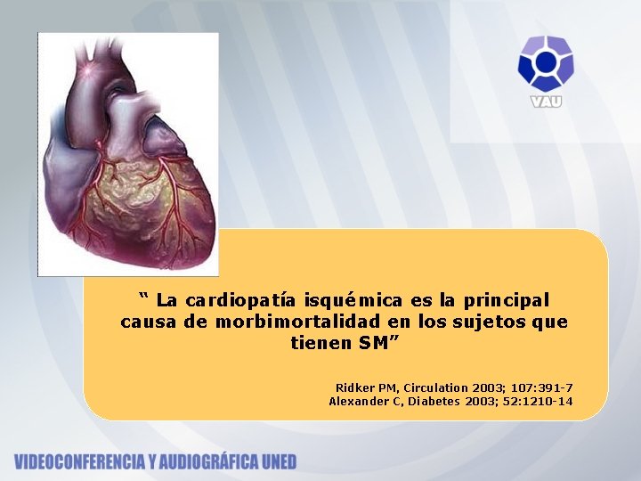 “ La cardiopatía isquémica es la principal causa de morbimortalidad en los sujetos que