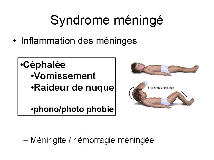 Syndrome méningé • Inflammation des méninges • Céphalée • Vomissement • Raideur de nuque