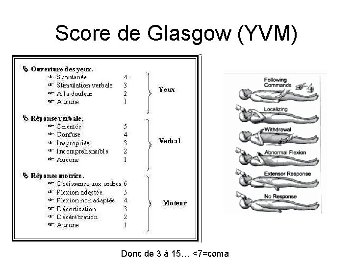 Score de Glasgow (YVM) Donc de 3 à 15… <7=coma 