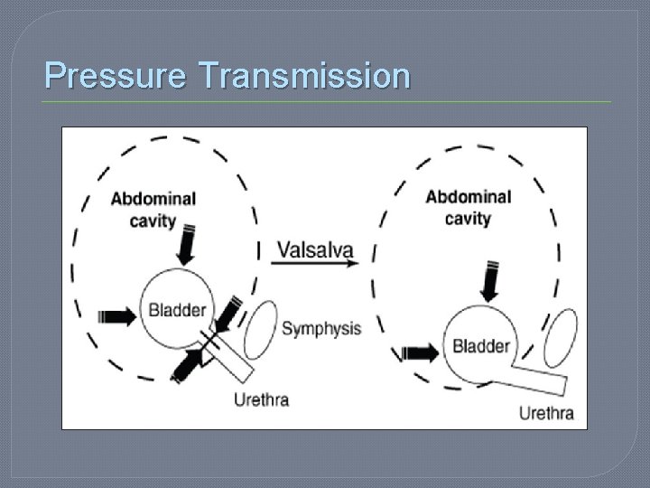 Pressure Transmission 