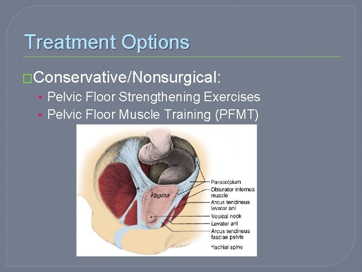 Treatment Options �Conservative/Nonsurgical: • Pelvic Floor Strengthening Exercises • Pelvic Floor Muscle Training (PFMT)