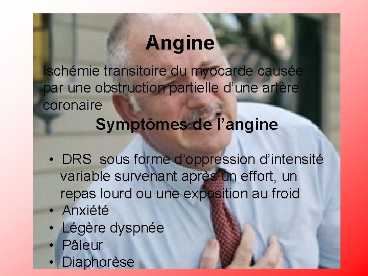 Angine Ischémie transitoire du myocarde causée par une obstruction partielle d’une artère coronaire Symptômes