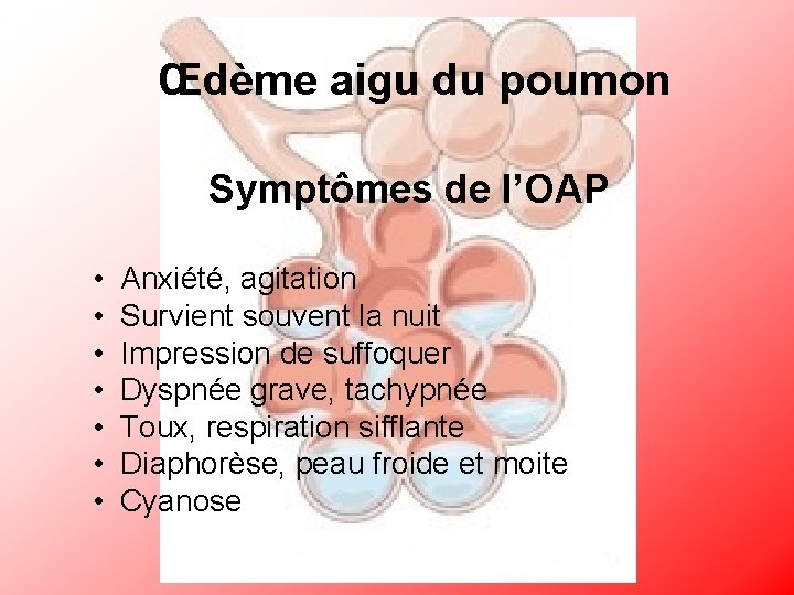 Œdème aigu du poumon Symptômes de l’OAP • Anxiété, agitation • Survient souvent la