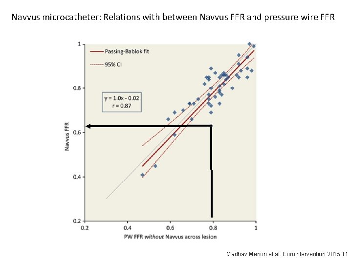 Navvus microcatheter: Relations with between Navvus FFR and pressure wire FFR Madhav Menon et