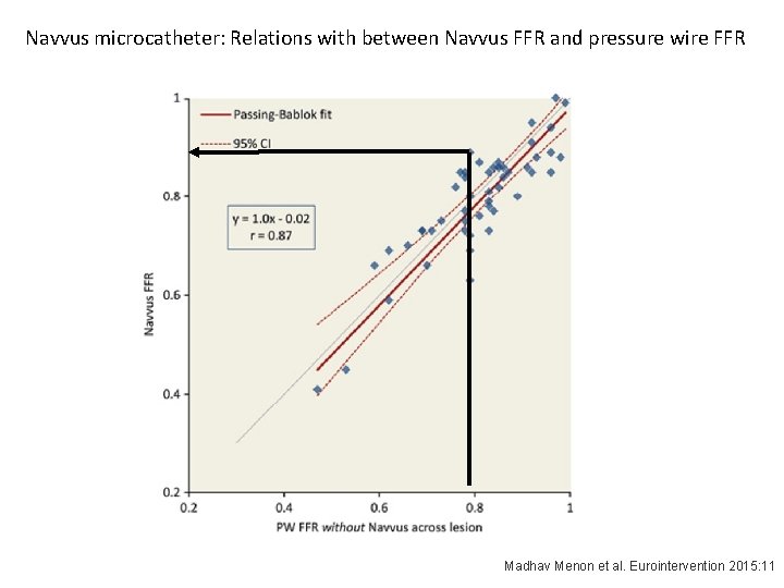 Navvus microcatheter: Relations with between Navvus FFR and pressure wire FFR Madhav Menon et