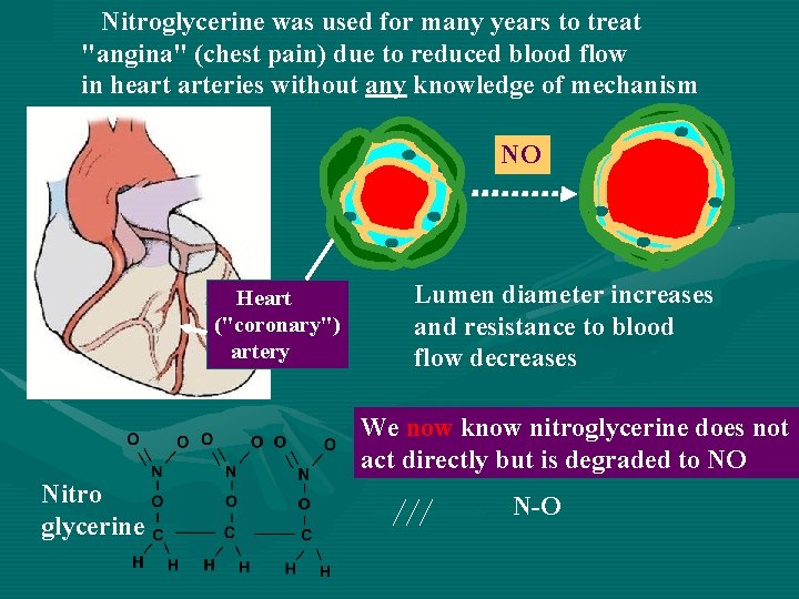 Nitroglycerine was used for many years to treat "angina" (chest pain) due to reduced
