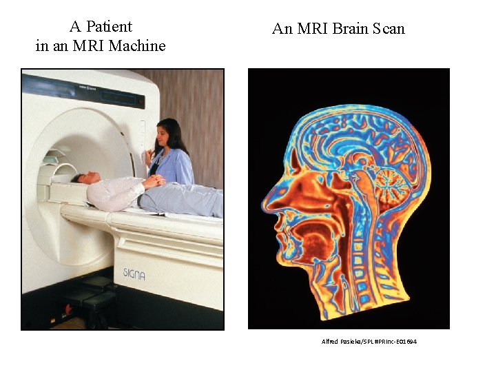 A Patient in an MRI Machine An MRI Brain Scan Alfred Pasieka/SPL #PRInc-E 01694