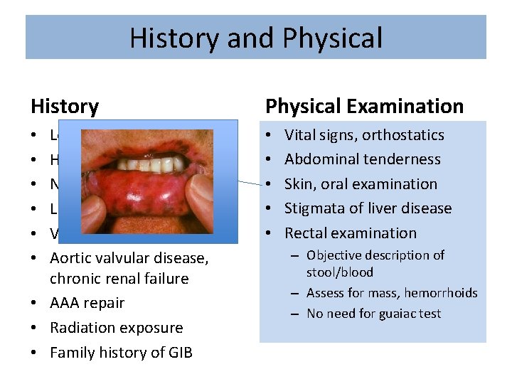 History and Physical History Physical Examination Localizing symptoms History of prior GIB NSAID/aspirin use