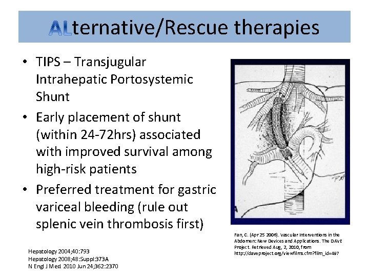 ternative/Rescue therapies • TIPS – Transjugular Intrahepatic Portosystemic Shunt • Early placement of shunt