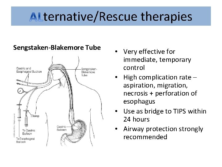 ternative/Rescue therapies Sengstaken-Blakemore Tube • Very effective for immediate, temporary control • High complication