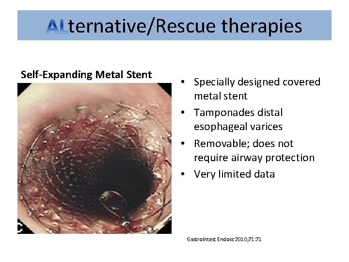 ternative/Rescue therapies Self-Expanding Metal Stent • Specially designed covered metal stent • Tamponades distal