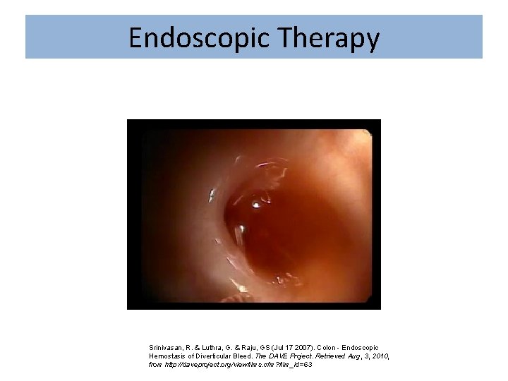 Endoscopic Therapy Srinivasan, R. & Luthra, G. & Raju, GS (Jul 17 2007). Colon